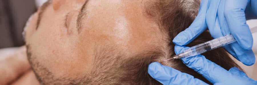 haarverdichtungmann | Haarverdichtung und Haartransplantation für Männer in Wien | Dozent Dr. Matiasek | Schönheitschirurg Wien